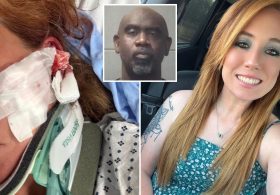 DoorDash mom left with skull fractures, brain bleeds after man allegedly follows her and attacks with bat