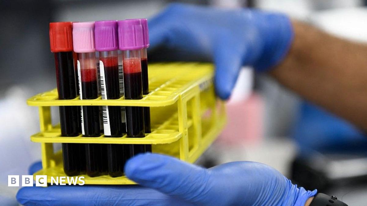 Red Cross declares crisis over blood supply shortage in US for second time in its history 6 46