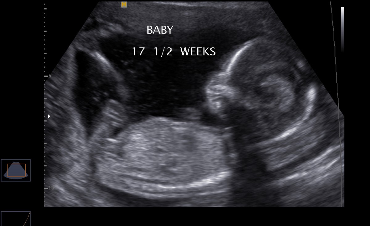 Surrogacy Is A Form Of Slavery. It Should Be Abolished ZZ111 002