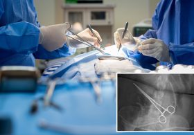Here are the states where medical malpractice runs rampant