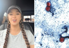 TikTok food critic, 29, details ‘miserable’ experience of contracting ‘explosive diarrhea’ parasite