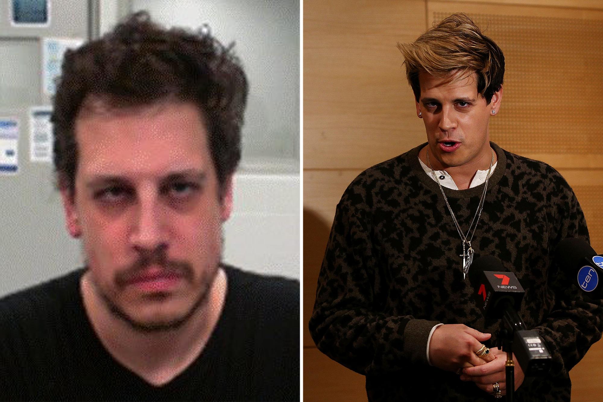 Disheveled Milo Yiannopoulos scowls in mugshot as he’s detained by ICE after ‘overstaying his welcome’ milo comp 1
