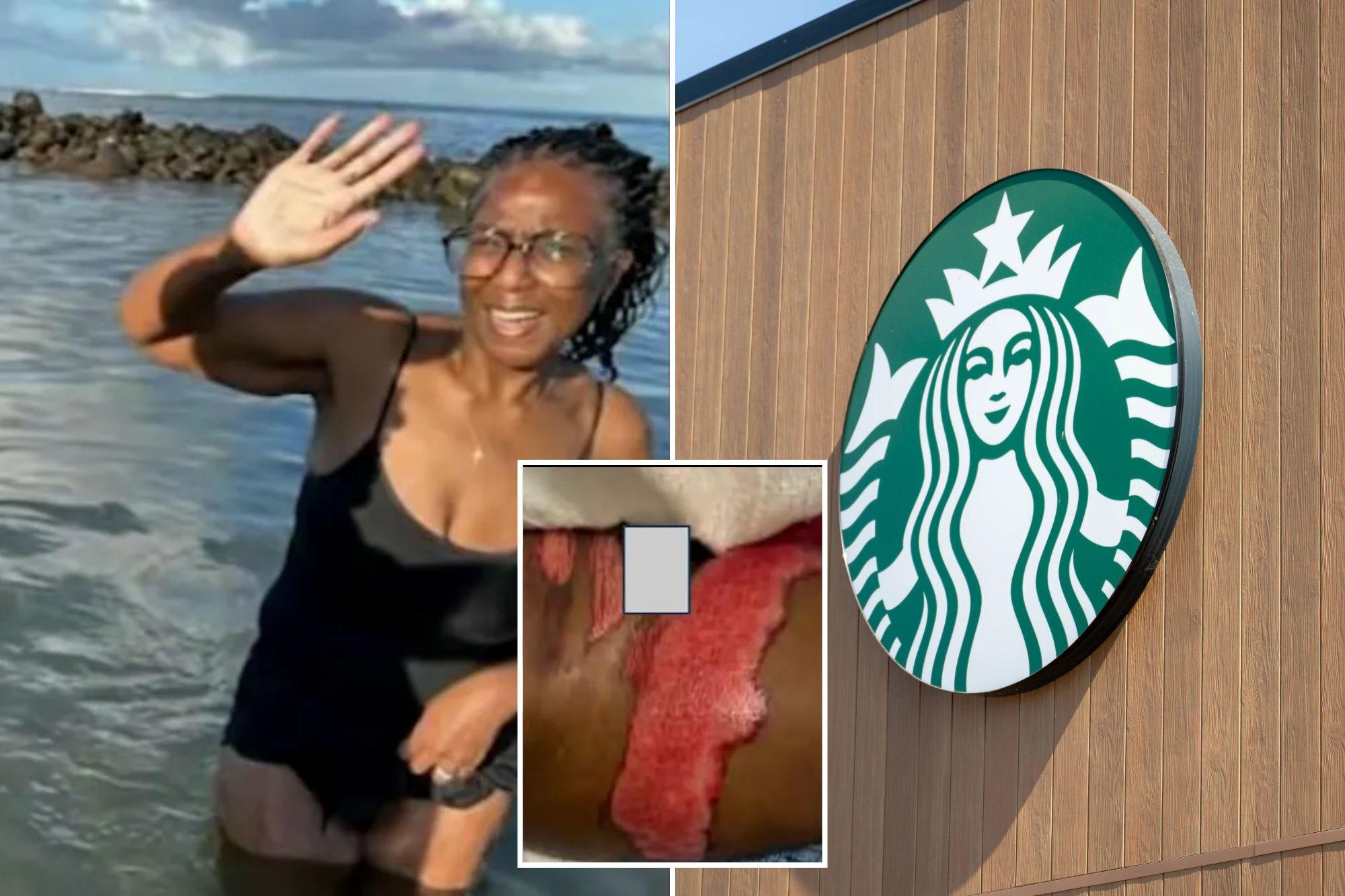 Starbucks horror as SoCal woman says boiling coffee spill led to surgery newspress collage vjo17tugt 1785557817593