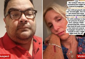 NYC synagogue attack victim punches back at unhinged assailant: ‘We will continue to sing’