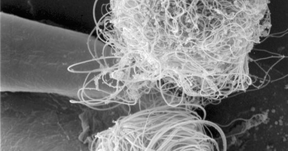 Scientists Map the Male Fruit Fly Brain. The Sex Differences Are Hard to Miss. 0 9657d567b099 1200x630 1
