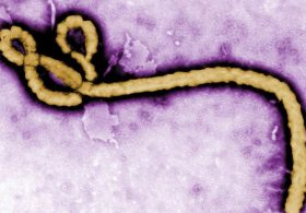Fauci Diary: Bury NIAID-Funded Army Ebola Aerosol Results