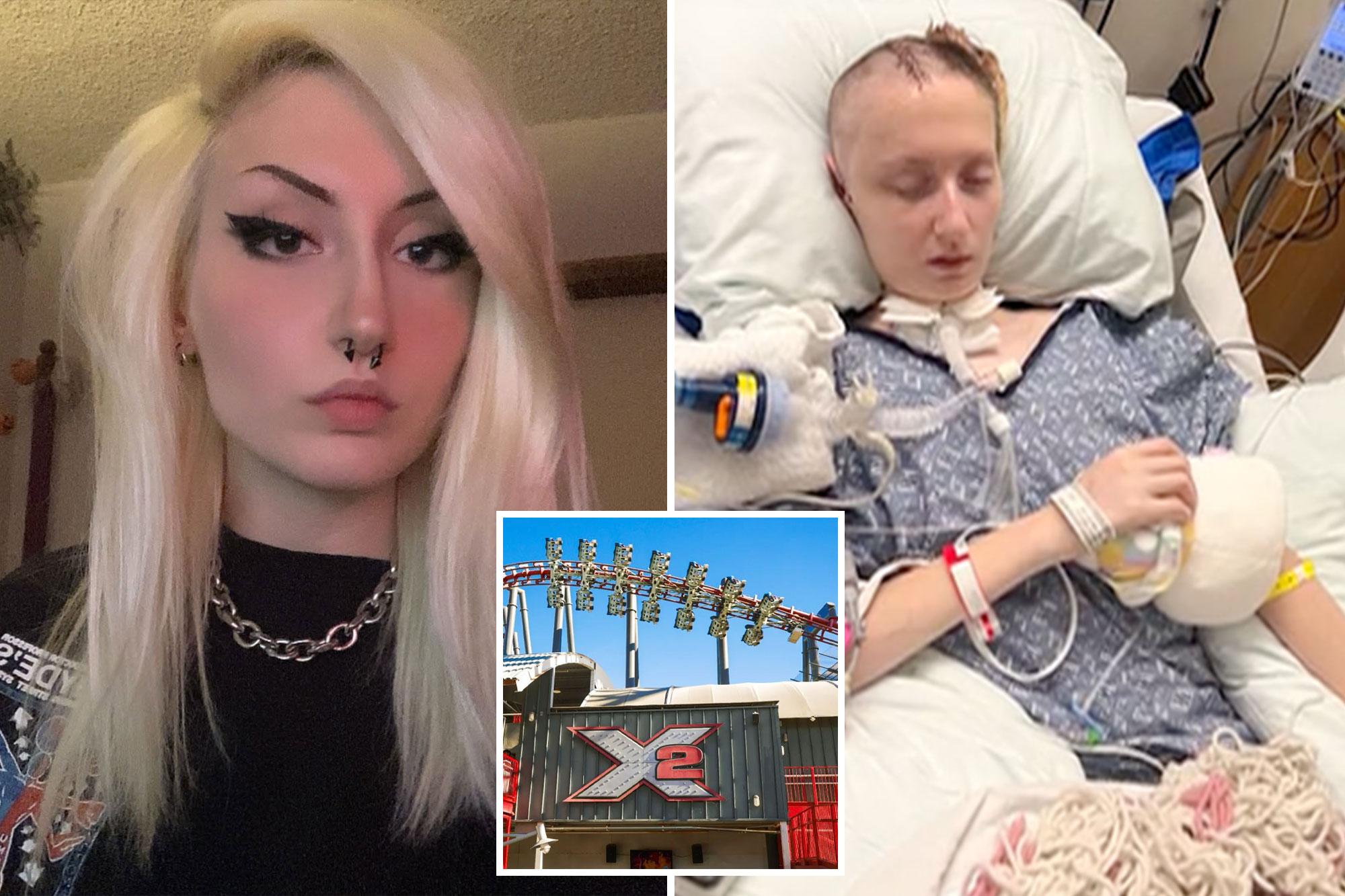 Harrowing pictures shows X2 rider still on ventilator two months after riding massive Six Flags coaster 142190736