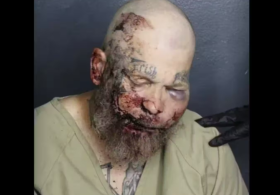 Whoa: Florida Man’s Mugshot After He Allegedly Tried to Fight Cop Tells the Story Itself