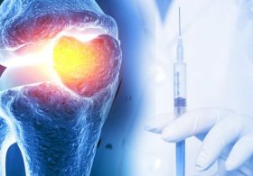 Just One Injection Could Keep Osteoarthritis Drugs Working for Weeks: New Gel Targets Pain at the Source