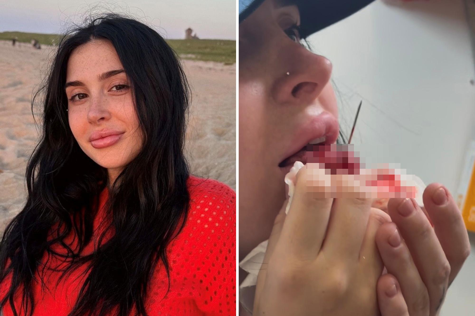 Shady NYC piercing shop butchered woman’s tongue, sending her to ER: lawsuit 146093914