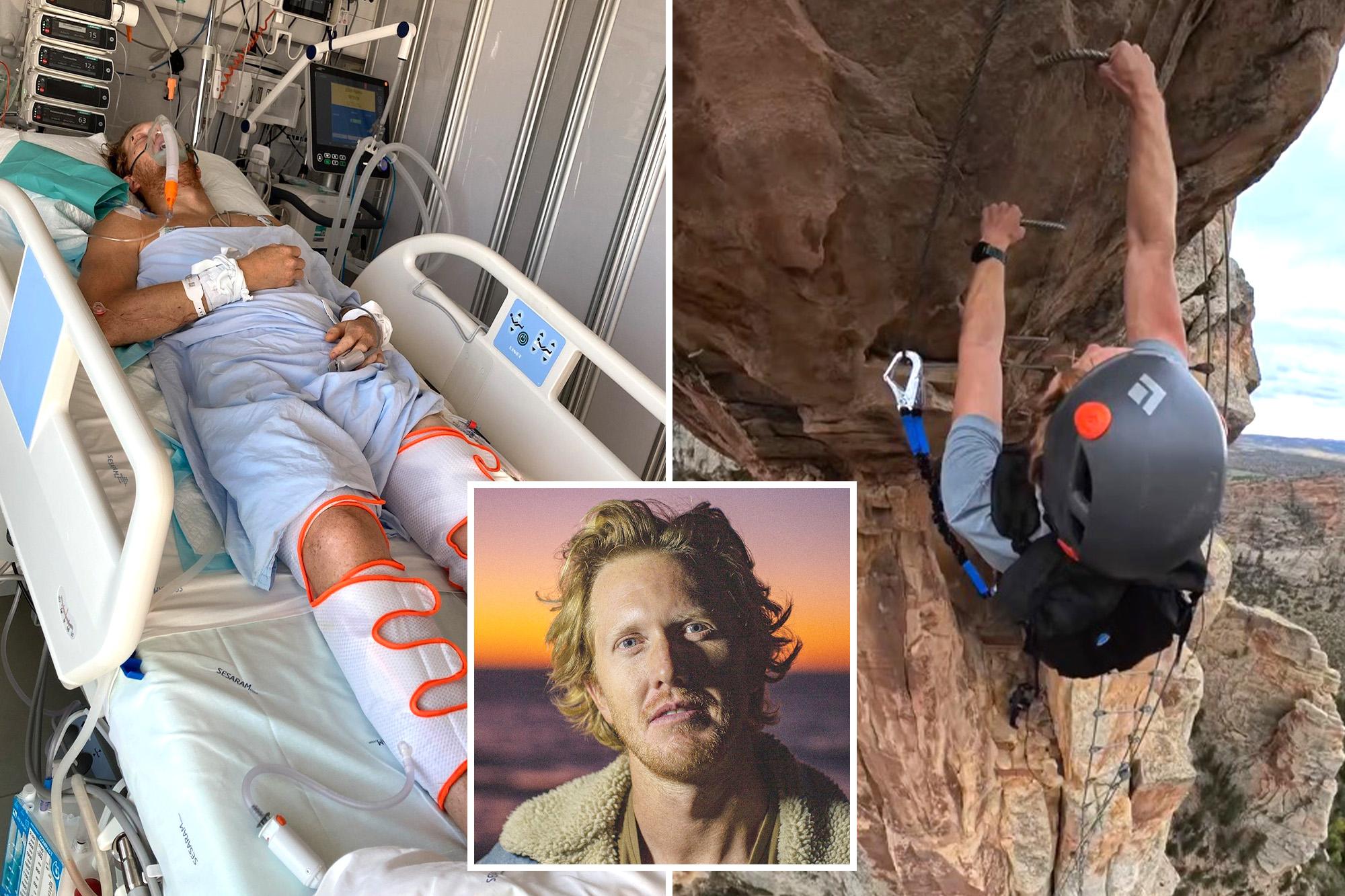 California adventure photographer fighting for his life after 200-foot plunge 146236681