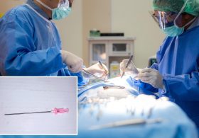 After 7 years of agony, NY mom discovers C-section surgeons left a needle in her belly: lawsuit