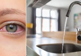 ‘Devastating’ amoeba lurking in tap water linked to permanent vision loss in Southern state