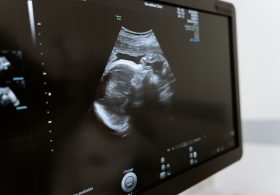 Virginia Judge Allows Post-Election Challenge To Late-Term Abortion Amendment