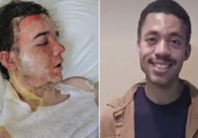 Young McDonald’s Worker in ICU After Co-Worker Doused Him in Boiling Oil, According to Horrified Mom