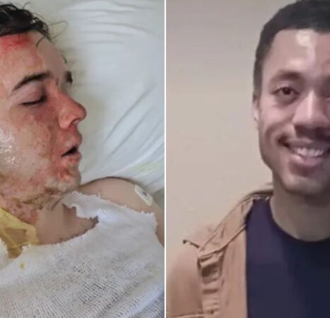 Young McDonald’s Worker in ICU After Co-Worker Doused Him in Boiling Oil, According to Horrified Mom