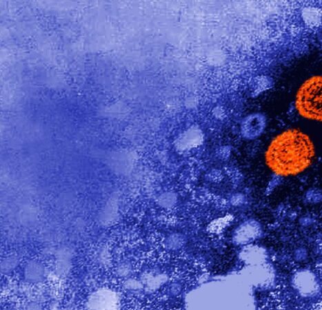Experimental Hepatitis B Drug Might Carry A “Functional Cure” For Specific Patients