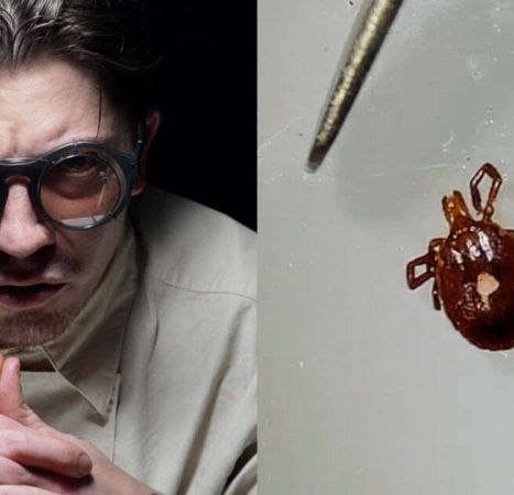 Fears Grow That Rapidly Spreading Meat-Allergy Tick Is Genetically Engineered Bioweapon