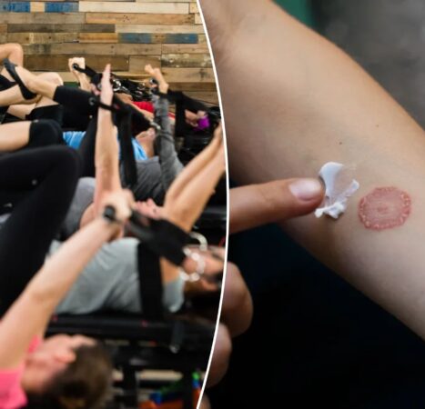 Premium $46-per-class fitness studio is leaving gymgoers with ringworm: reports