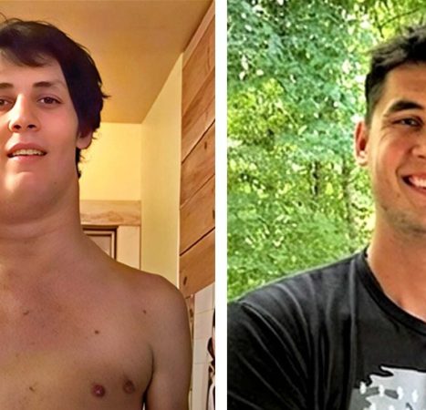 Tennessee Teen Drenched in Glyphosate Spent Next 7 Years Fighting ‘Massive Alien’ Tumor