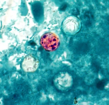 Yet another cyclosporiasis outbreak appears as cases linked to recalled lettuce grow