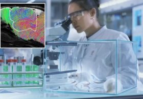 Stanford geniuses create lab rats with half-human brains